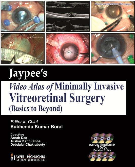 JAYPEE VIDEO ATLAS OF MINIMALLY INVASIVE VITREORETINAL SURGERY 1ST/2013 - SUBHENDU KUMAR BORAL