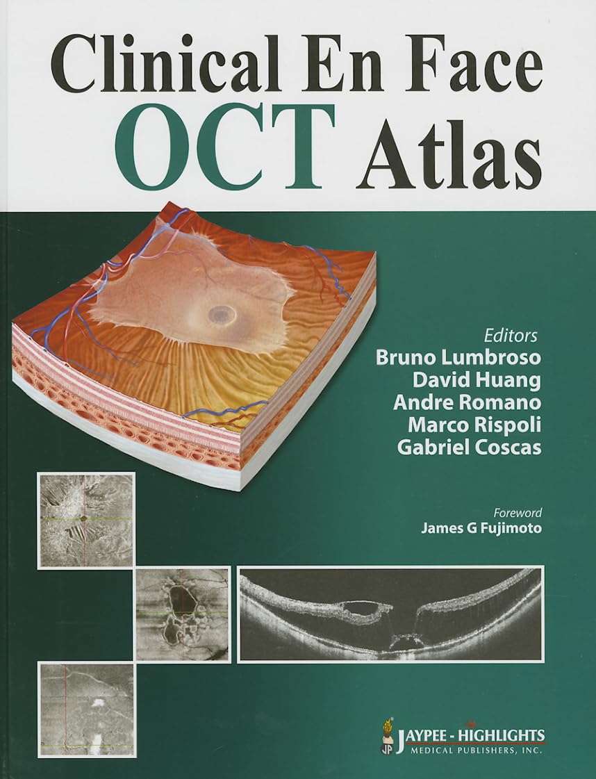 CLINICAL EN FACE OCT ATLAS 1ST/2013 - BRUNO LUMBROSO