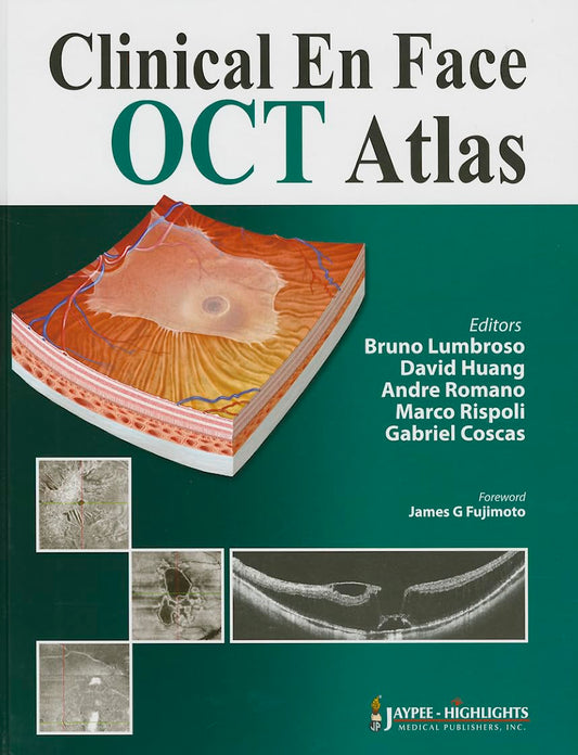 CLINICAL EN FACE OCT ATLAS 1ST/2013 - BRUNO LUMBROSO