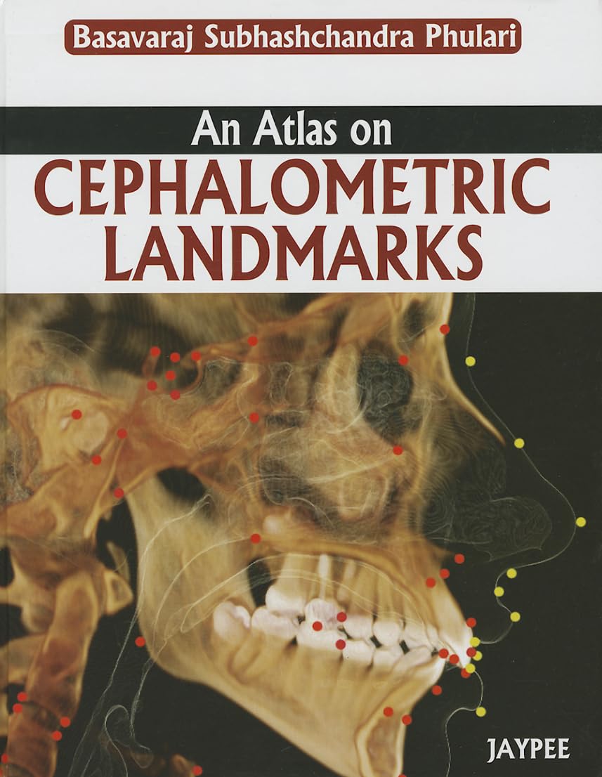 AN ATLAS ON CEPHALOMETRIC LANDMARKS 1ST/2013 - BASAVARAJ SUBHASHCHANDRA PHULARI