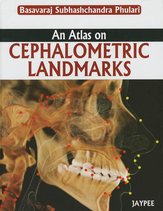 AN ATLAS ON CEPHALOMETRIC LANDMARKS 1ST/2013 - BASAVARAJ SUBHASHCHANDRA PHULARI