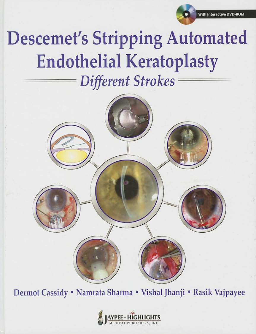DESCEMET'S STRIPPING AUTOMATED ENDOTHELIAL KERATOPLASTY:DIFFERENT STROKES 1ST/2013 - DERMOT CASSIDY