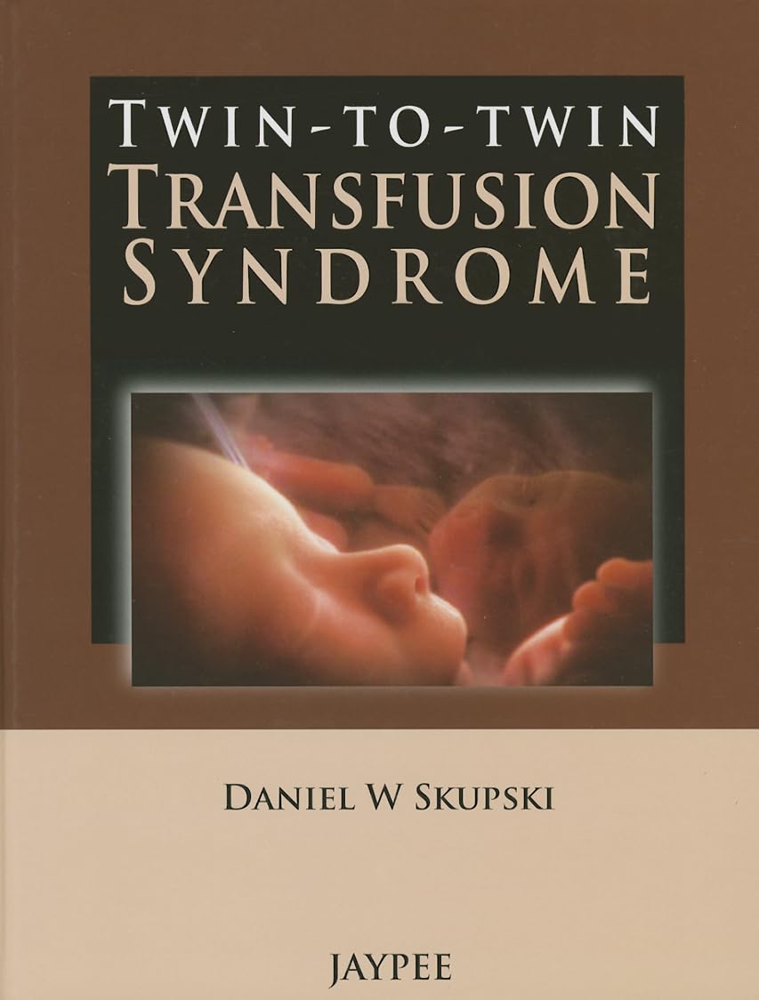 TWIN-TO-TWIN TRANSFUSION SYNDROME 1ST/2013 - DANIEL W SKUPSKI