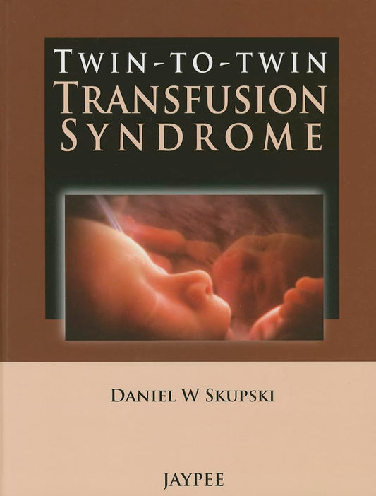 TWIN-TO-TWIN TRANSFUSION SYNDROME 1ST/2013 - DANIEL W SKUPSKI