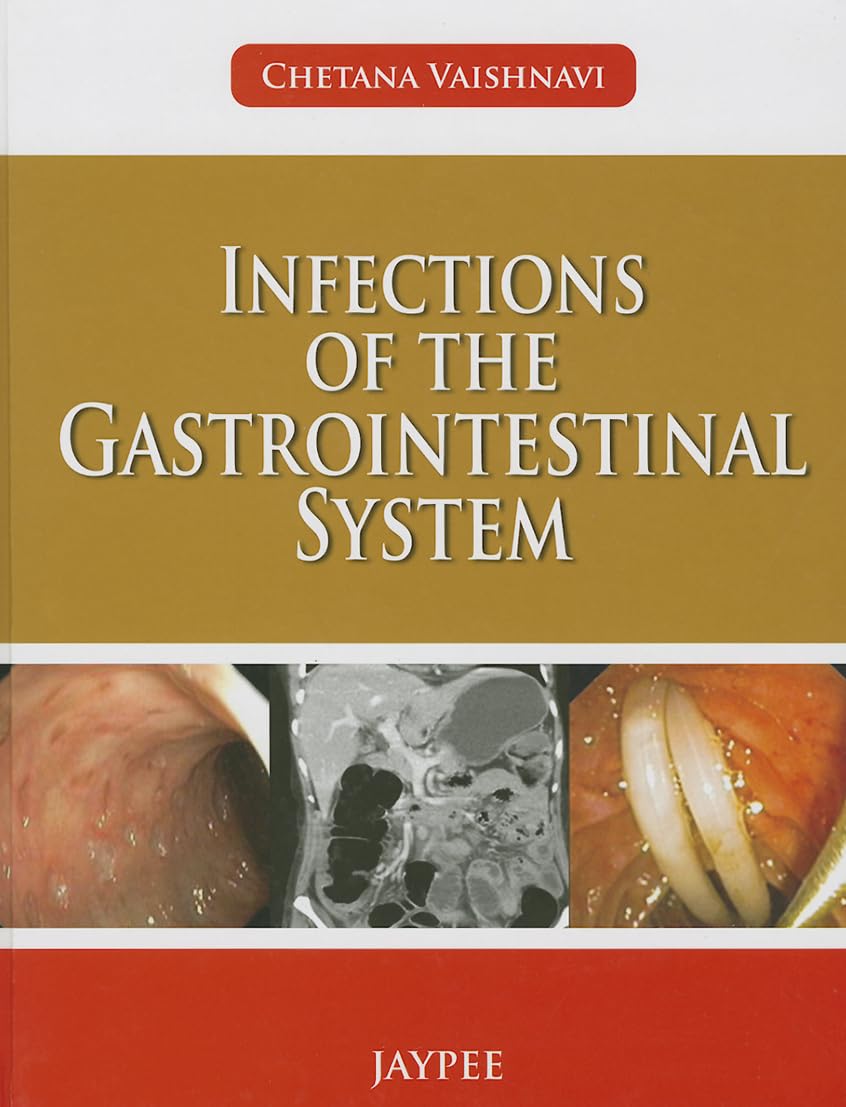 INFECTIONS OF THE GASTROINTESTINAL SYSTEM 1ST/2013 - CHETNA VAISHNAVI