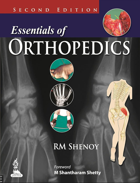 ESSENTIALS OF ORTHOPEDICS 2ND/2026 - RM SHENOY