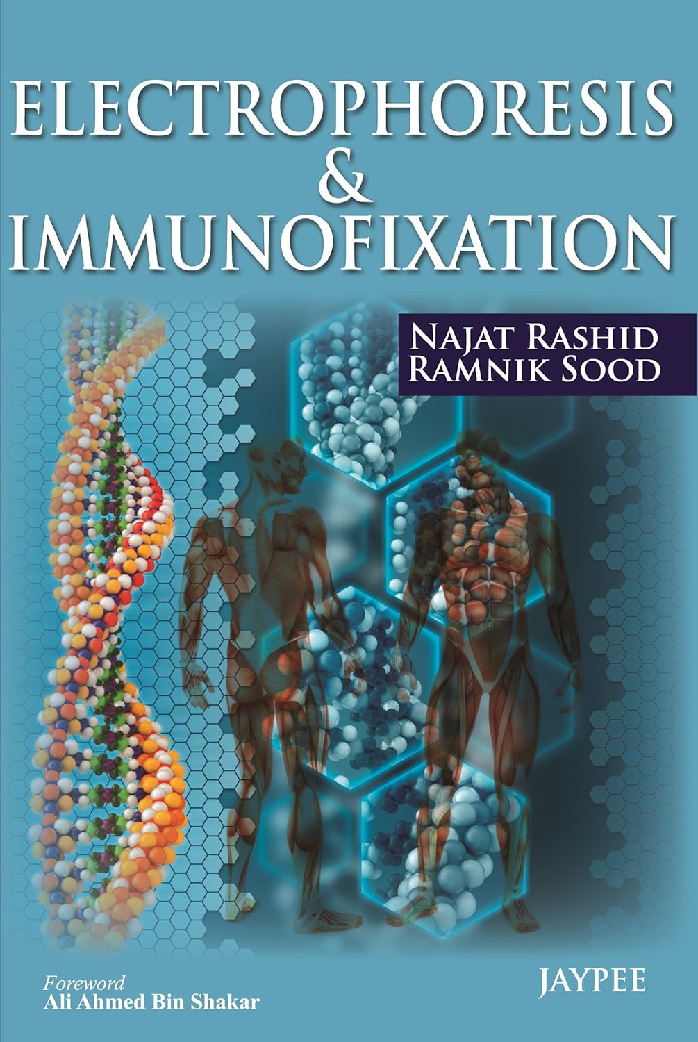ELECTROPHORESIS & IMMUNOFIXATION 1ST/2013 - NAJAT RASHID