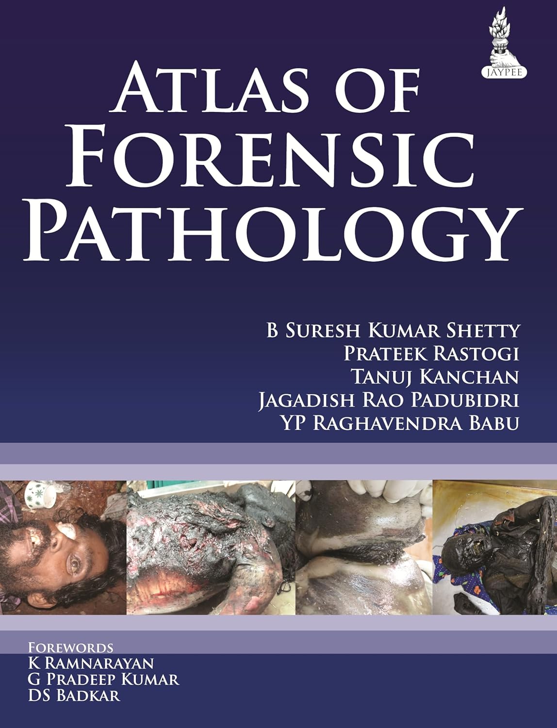 ATLAS OF FORENSIC PATHOLOGY 1ST/2026 - B SURESH KUMAR SHETTY