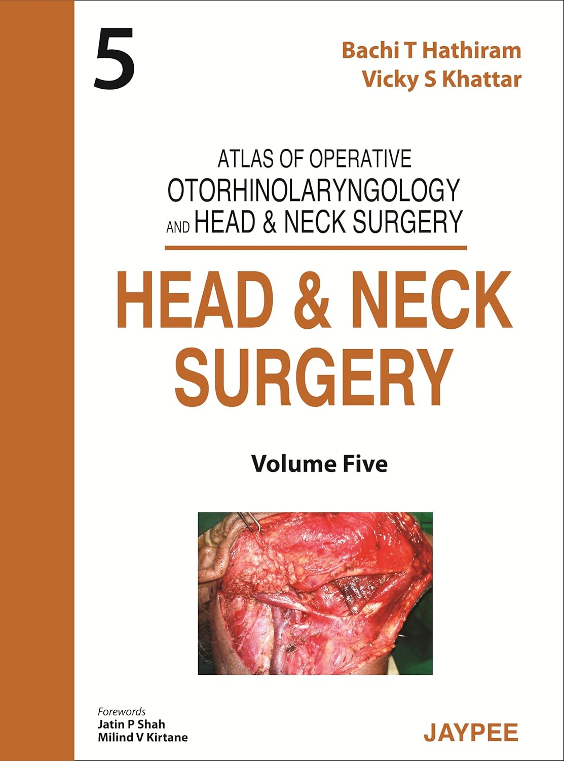 ATLAS OF OPERATIVE OTORHINOLARYNGOLOGY AND HEAD & NECK SURGERY (VOLUME-5): HEAD AND NECK SURGERY 1ST/2013 - BACHI T HATHIRAM, VICKY S KHATTAR