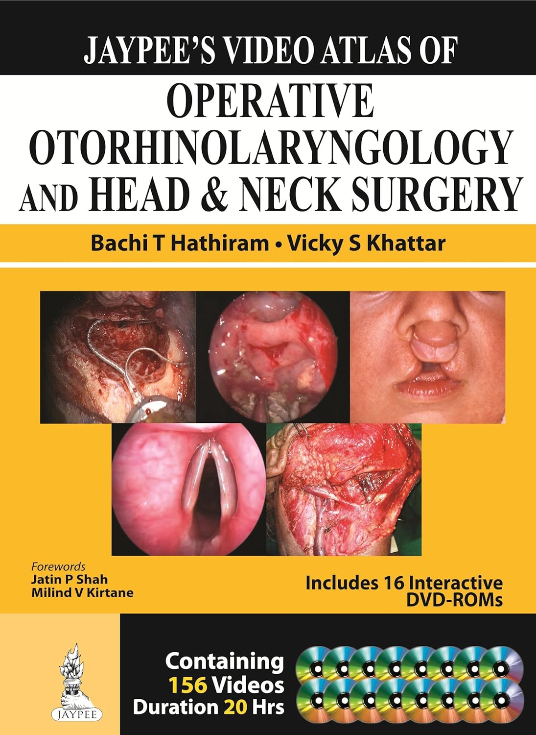 JAYPEE'S VIDEO ATLAS OF OPERATIVE ORORHINLOARYNGOLOGY & HEAD & NECK SURGERY 16 DVD 1ST/2014 - BATCHI T HATHIRAM