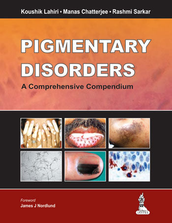 PIGMENTARY DISORDERS A COMPREHENSIVE COMPENDIUM 1ST/2014-KOUSHIK LAHIRI
