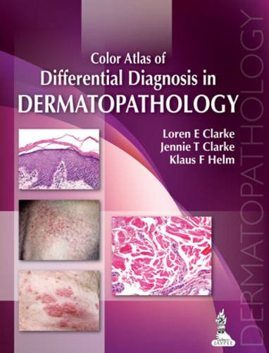 COLOR ATLAS OF DIFFERENTIAL DIAGNOSIS IN DERMATOPATHOLOGY 1ST/2014 - LOREN E CLARKE