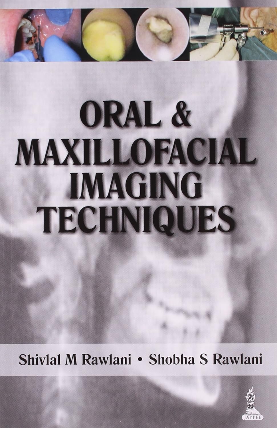 ORAL & MAXILLOFACIAL IMAGING TECHNIQUES 1ST/2014 - SHIVLAL M RAWLANI