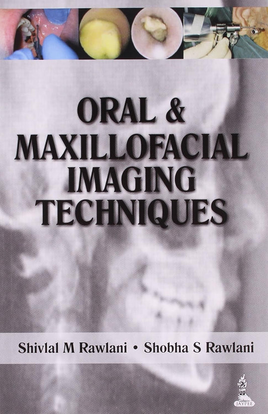 ORAL & MAXILLOFACIAL IMAGING TECHNIQUES 1ST/2014 - SHIVLAL M RAWLANI