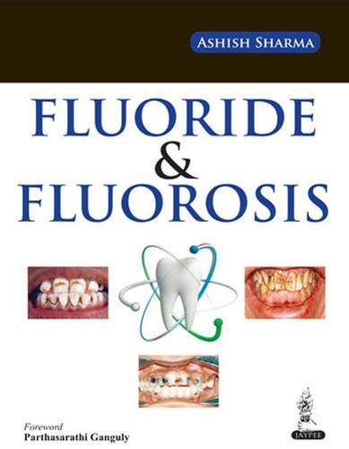 FLUORIDE & FLUOROSIS 1ST/2014 - ASHISH SHARMA