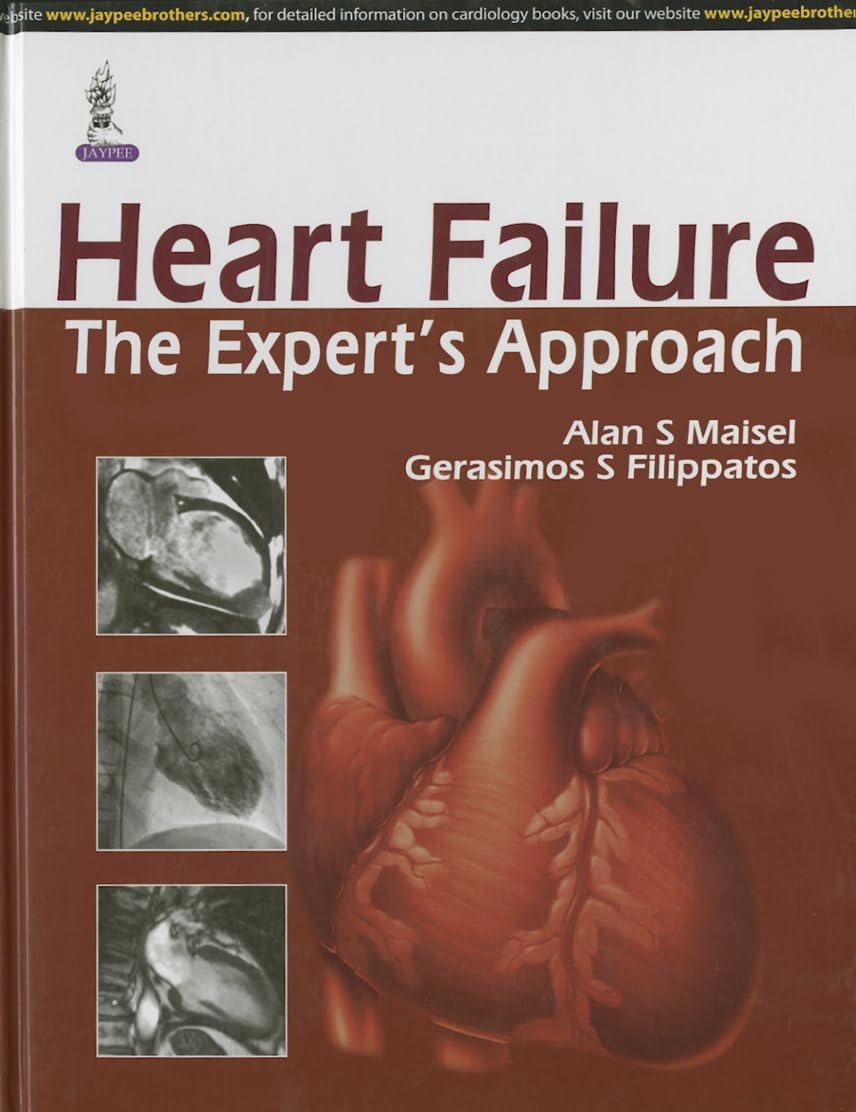 HEART FAILURE THE EXPERT'S APPROACH 1ST/2014 - ALAN S MAISEL