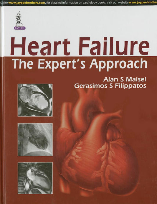 HEART FAILURE THE EXPERT'S APPROACH 1ST/2014 - ALAN S MAISEL