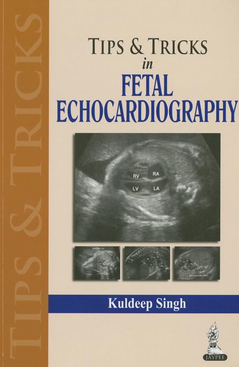 TIPS & TRICS IN FETAL ECHOCARDIOGRAPHY 1ST/2014 - KULDEEP SINGH