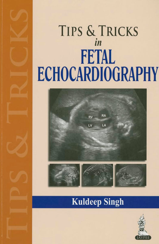 TIPS & TRICS IN FETAL ECHOCARDIOGRAPHY 1ST/2014 - KULDEEP SINGH