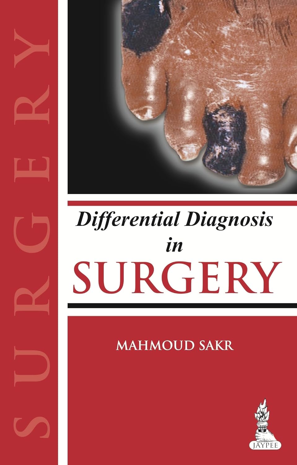 DIFFERENTIAL DIAGNOSIS IN SURGERY 1ST/2014 - MAHMOUD SAKR