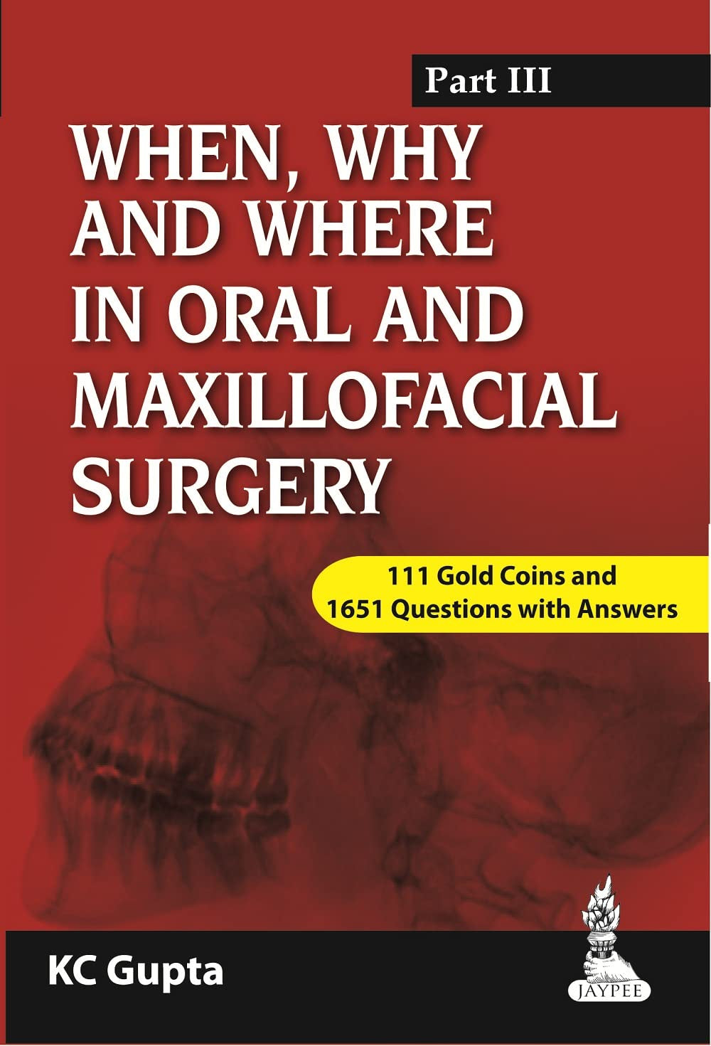 WHEN,WHY AND WHERE IN ORAL AND MAXILLOFACIAL SURGERY PART III 1ST/2014 - KC GUPTA