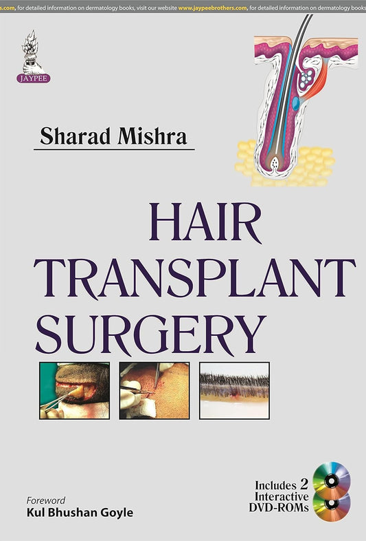 HAIR TRANSPLANT SURGERY 1ST/2014 - SHARAD MISHRA