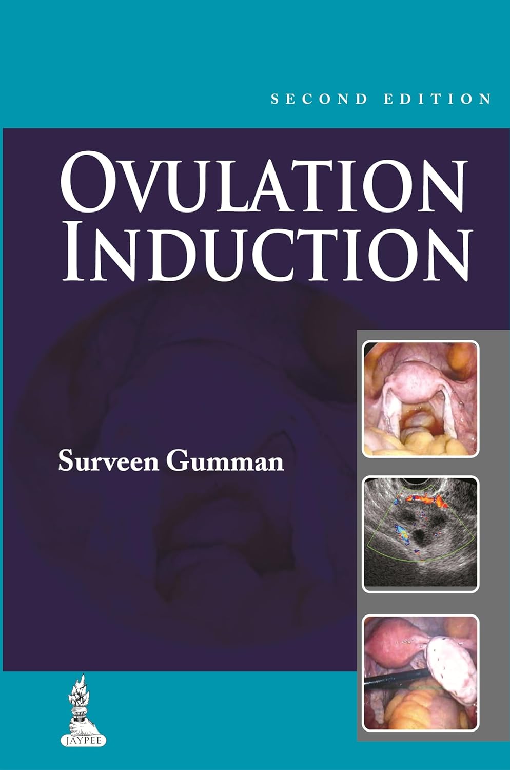 STEP BY STEP OVULATION INDUCTION WITH CD-ROM 2ND/2014 - SURVEEN GHUMMAN