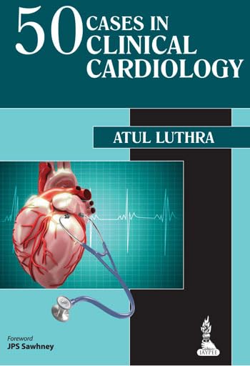 50 CASES IN CLINICAL CARDIOLOGY 1E/2014