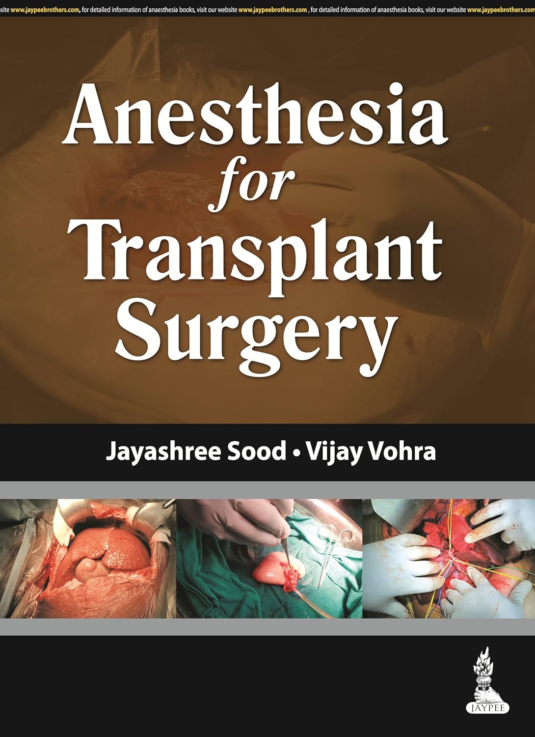 ANESTHESIA FOR TRANSPLANT SURGERY 1ST/2014 - JAYASHREE SOOD
