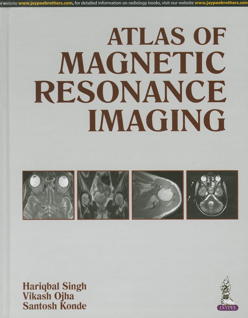 ATLAS OF MAGNETIC RESONANCE IMAGING 1ST/2014 - HARIQBAL SINGH