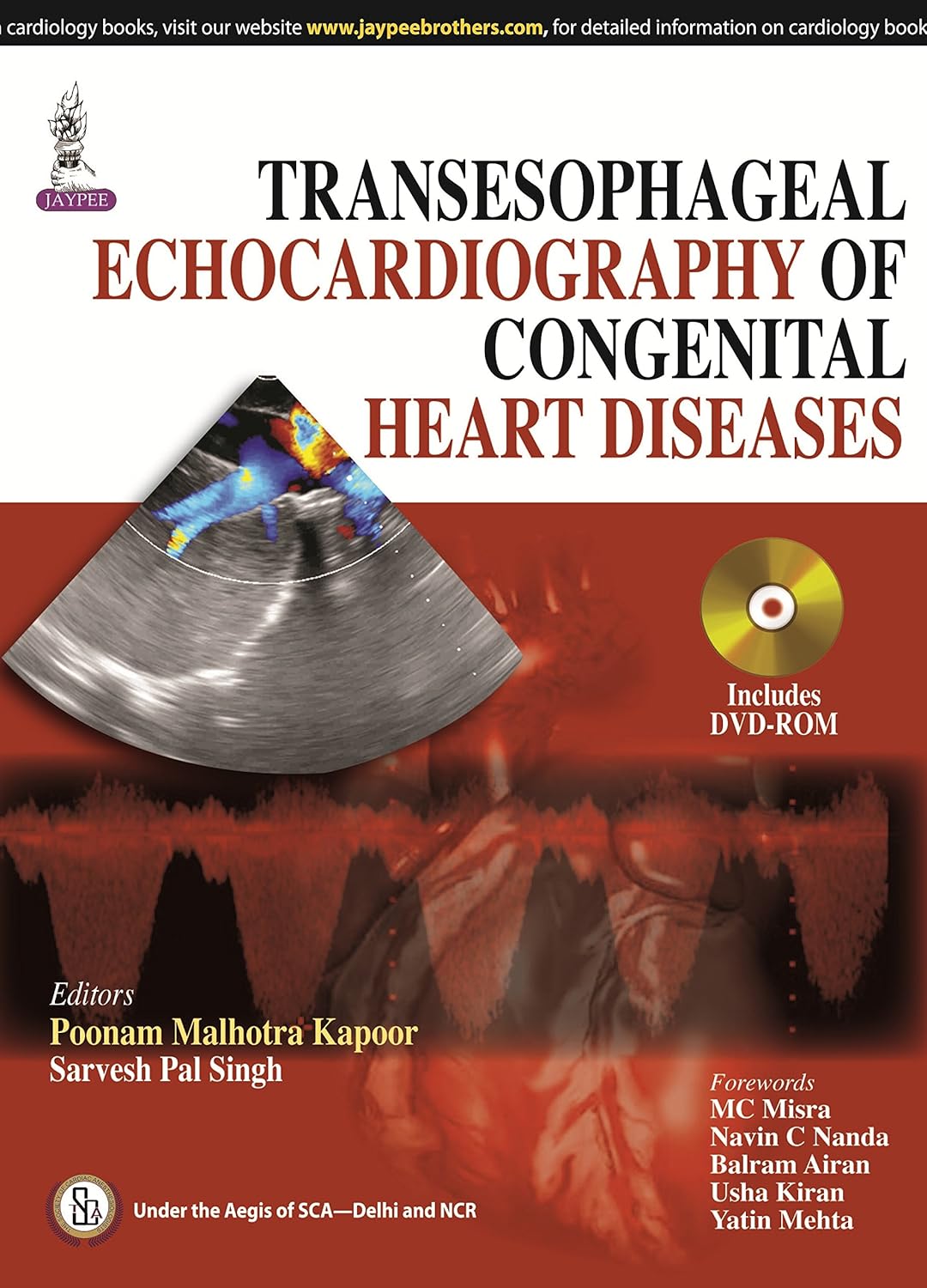 TRANSESOPHAGEAL ECHOCARDIOGRAPHY OF CONGENITAL HEART DISEASES 1ST/2014 - POONAM MALHOTRA KAPOOR
