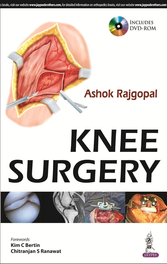KNEE SURGERY INCLUDES DVD-ROM 1ST/2014 - ASHOK RAJGOPAL