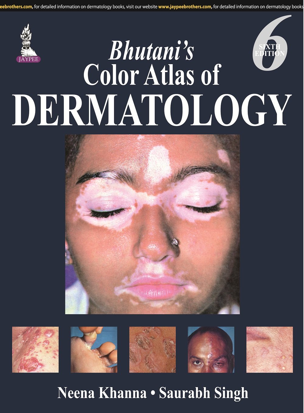 BHUTANI'S COLOR ATLAS OF DERMATOLOGY 6TH/2015 - NEENA KHANNA
