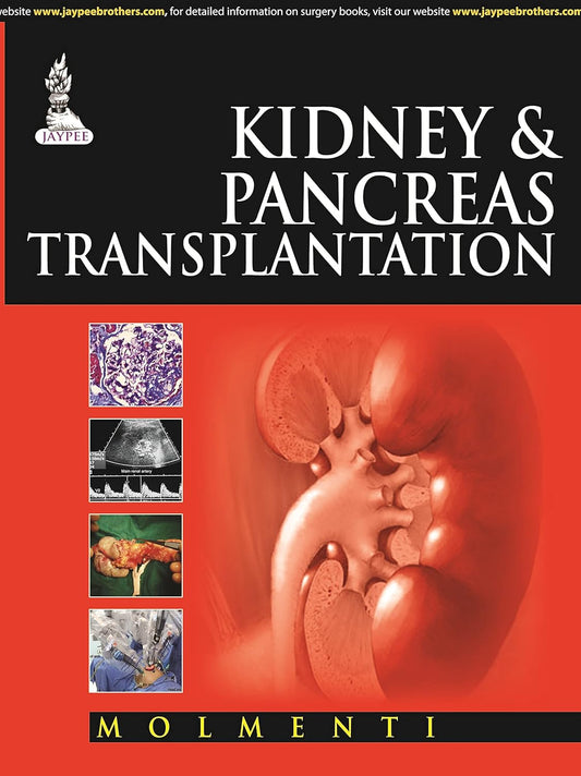 KIDNEY & PANCREAS TRANSPLANTATION 1ST/2015 - ERNESTO POMPEO MOLMENTI