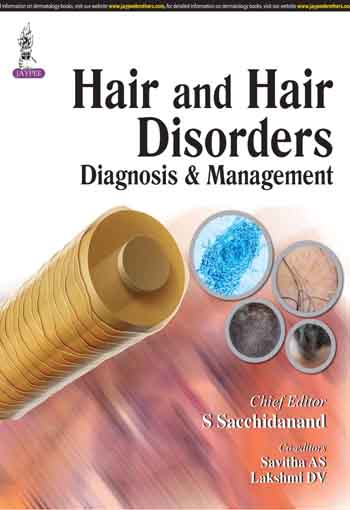 Hair and Hair Disorders: Diagnosis & Management 1ST/2015