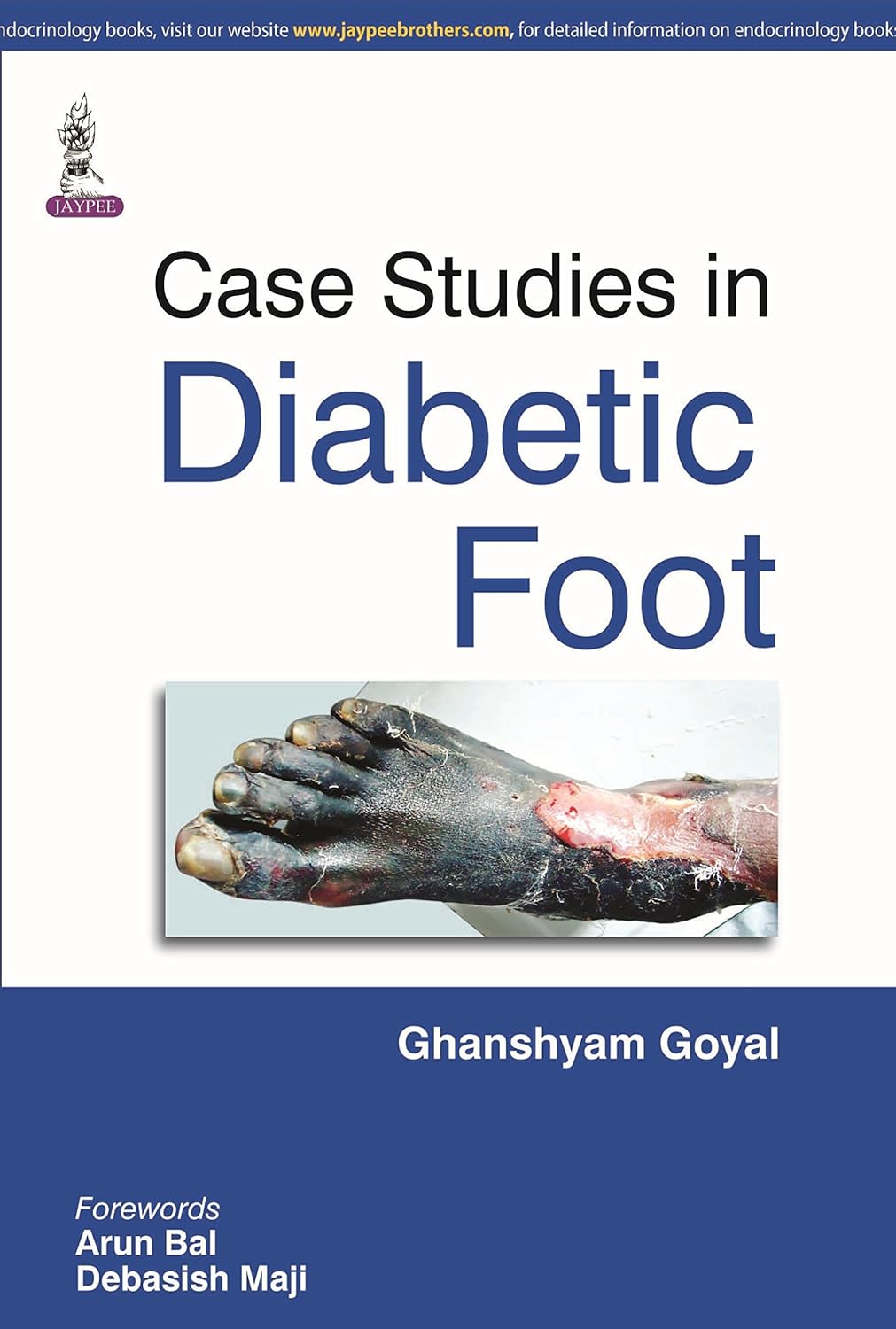 CASE STUDIES IN DIABETIC FOOT 1ST/2014 - GHANSHYAM GOYAL