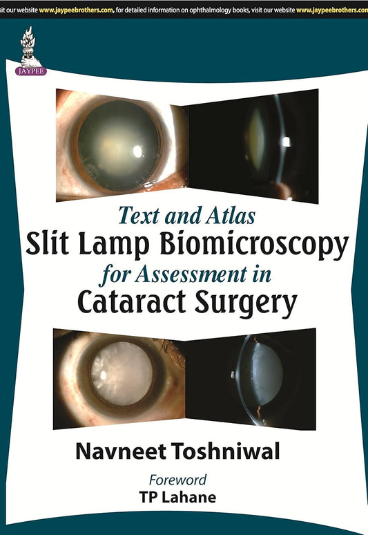 TEXT AND ATLAS SLIT LAMP BIOMICROSCOPY FOR ASSESSMENT IN CATARACT SURGERY 1ST/2014 - NAVNEET TOSHNIWAL