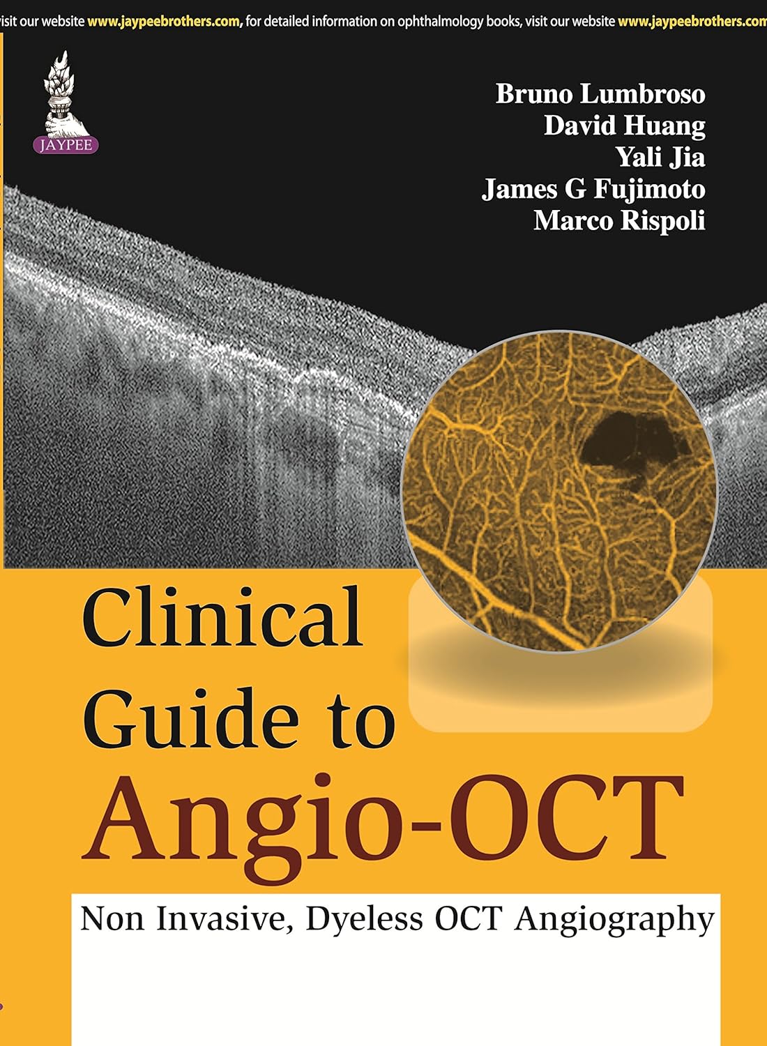 CLINICAL GUIDE TO ANGIO-OCT: NON INVASIVE,DYELESS OCT ANGIOGRAPHY 1ST/2015 - BRUNO LUMBROSO