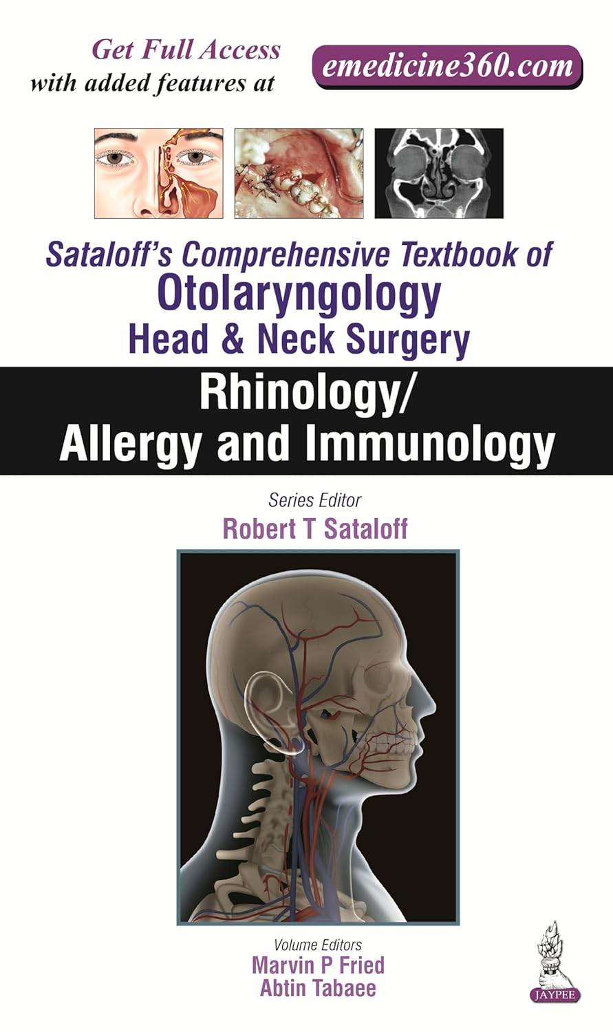 SATALOFF'S COMPREHENSIVE.TB.OF OTOLARY. HEAD&NECK SURGERY RHINOLOGY/ALLERY AND IMMUNOLOGY VOL.2 1ST/2016 - FRIED MARVIN P