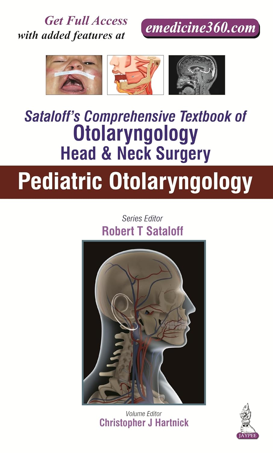 SATALOFF'S COMPREHENSIVE TB.OF OTOLARYNGOLOGY HEAD&NECK SURGERY PEDIATRIC OTOLARYNGOLOGY VOL.6 1ST/2016 - HARTNICK CHRISTOPHER J