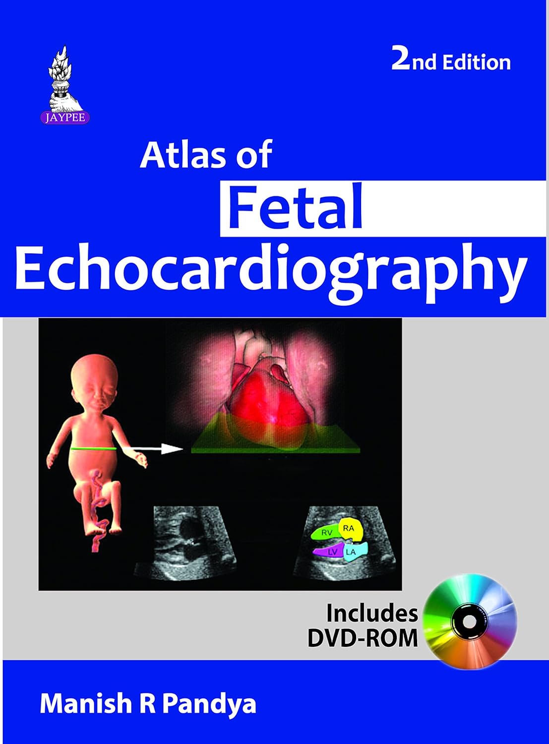 ATLAS OF FETAL ECHOCARDIOGRAPHY 2ND/2015 - MANISH R PANDYA
