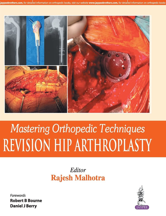 MASTERING ORTHOPEDIC TECHNIQUES REVISION HIP ARTHROPLASTY 1ST/2017 - RAJESH MALHOTRA
