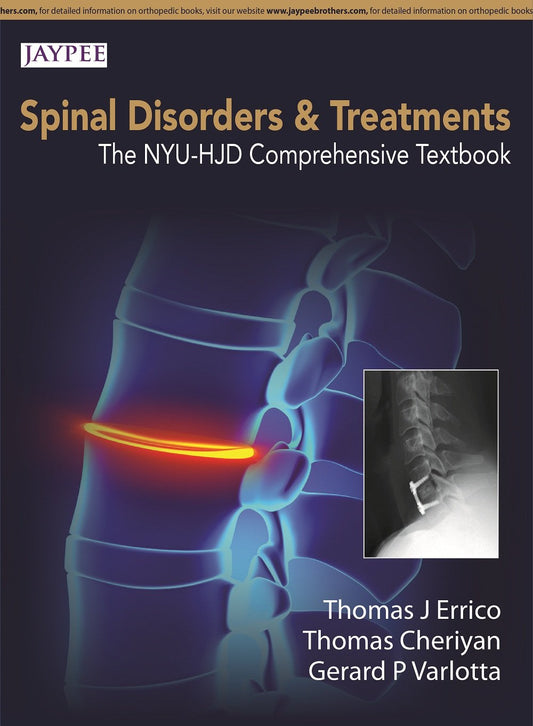 SPINE DISORDERS AND TREATMENTS:THE NYU-HJD COMPREHENSIVE TEXTBOOK 1ST/2015 - THOMAS J ERRICO