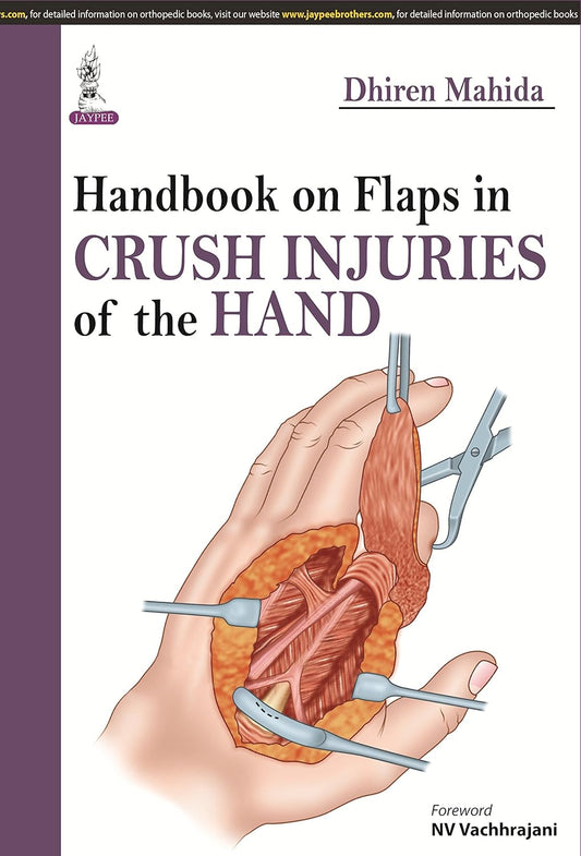 HANDBOOK ON FLAPS IN CRUSH INJURIES OF THE HAND 1ST/2015 - DHIREN MAHIDA
