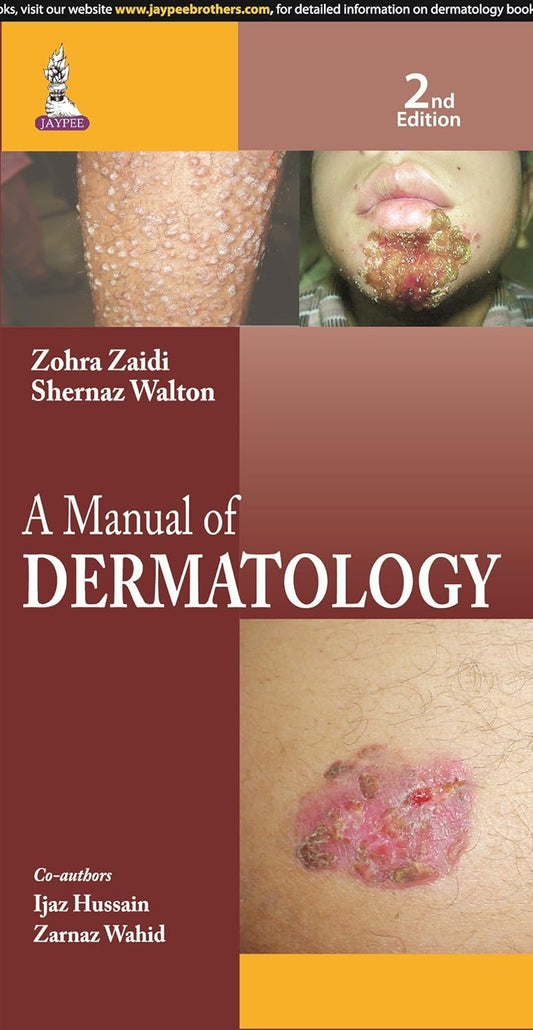 A MANUAL OF DERMATOLOGY 2ND/2015 - ZOHRA ZAIDI