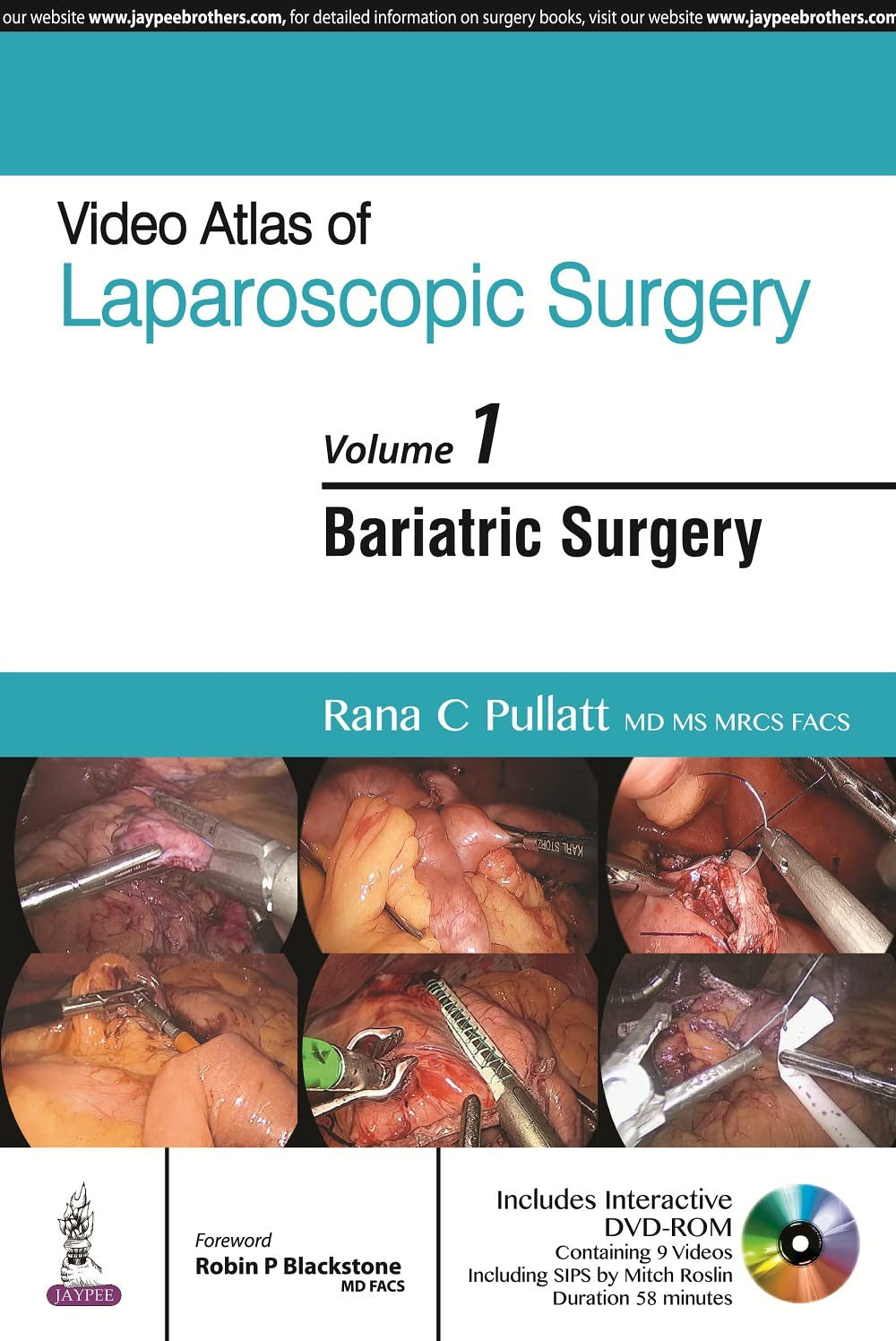 VIDEO ATLAS OF LAPAROSCOPIC SURGERY VOL.1 BARIATRIC SURGERY WITH DVD-ROM 1ST/2016 - RANA C PULLATT