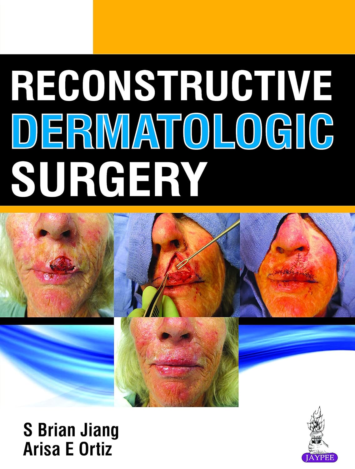 RECONSTRUCTIVE DERMATOLOGIC SURGERY 1ST/2018 - S BRIAN JIANG