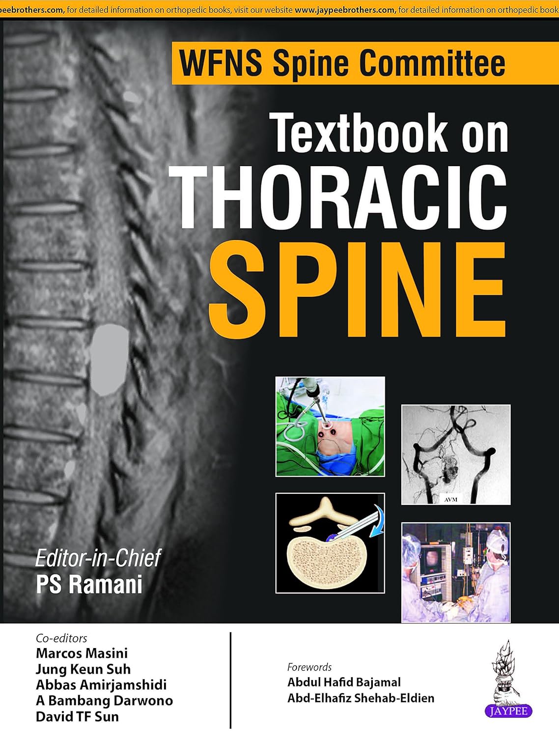 WFNS SPINE COMMITTEE TEXTBOOK ON THORACIC SPINE 1ST/2016 - PS RAMANI