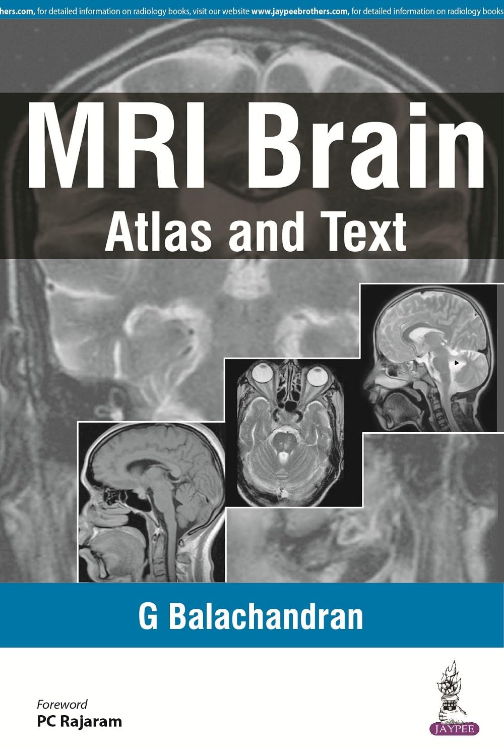 MRI BRAIN:ATLAS AND TEXT 1ST/2026 - G BALACHANDRAN