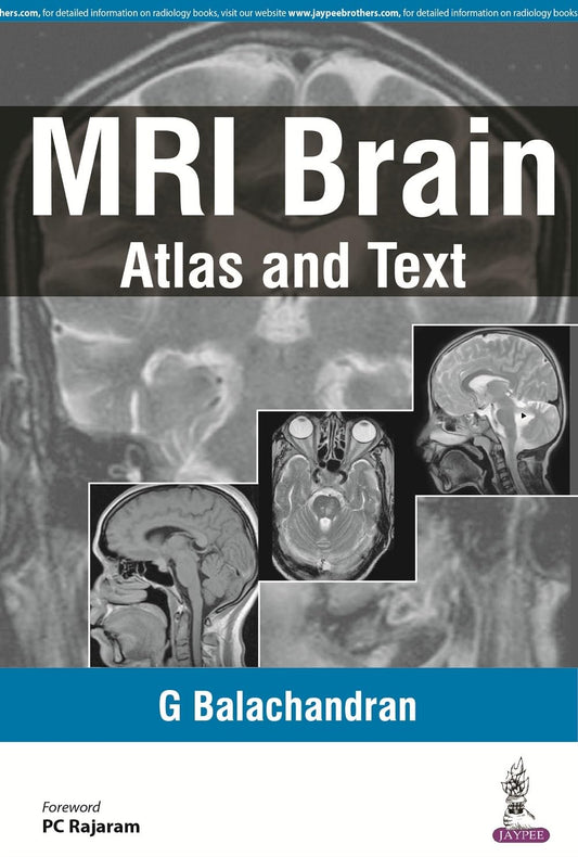 MRI BRAIN:ATLAS AND TEXT 1ST/2026 - G BALACHANDRAN